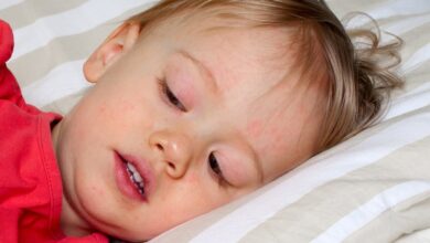 A word of caution regarding scarlet fever