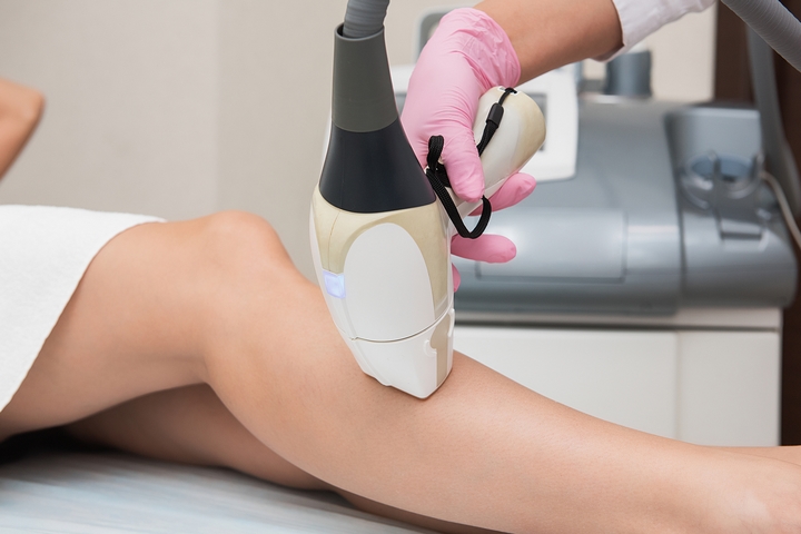 Forever Smooth: What to Expect During Laser Hair Removal