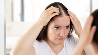 5 tips for women struggling with alopecia