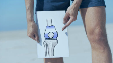 Knee Replacement Surgery in Turkey