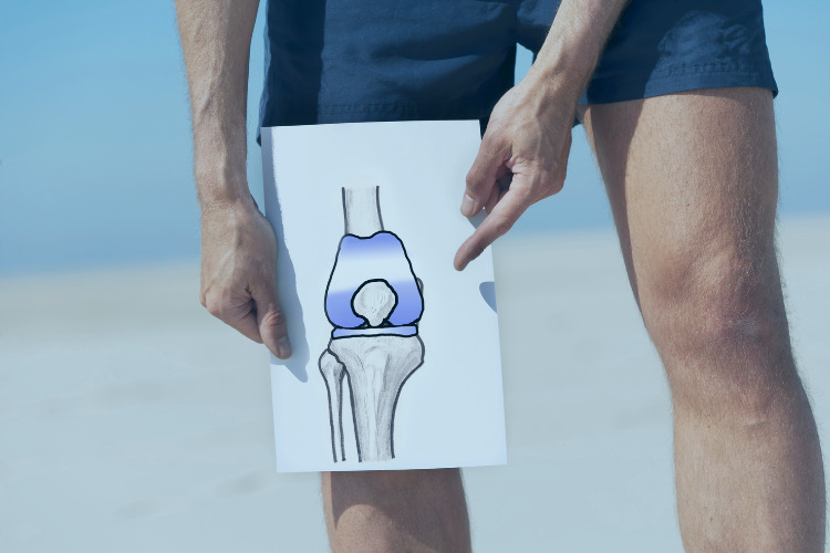 Knee Replacement Surgery in Turkey